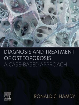 cover image of Diagnosis and Treatment of Osteoporosis